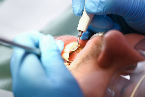 Best Weekend Emergency Dentist in Rosewood Heights, IL