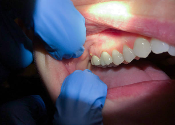 Best After-Hours Emergency Dentist in Rosewood Heights, IL