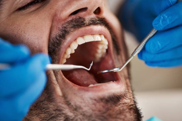 Best Pediatric Emergency Dentist in Rosewood Heights, IL